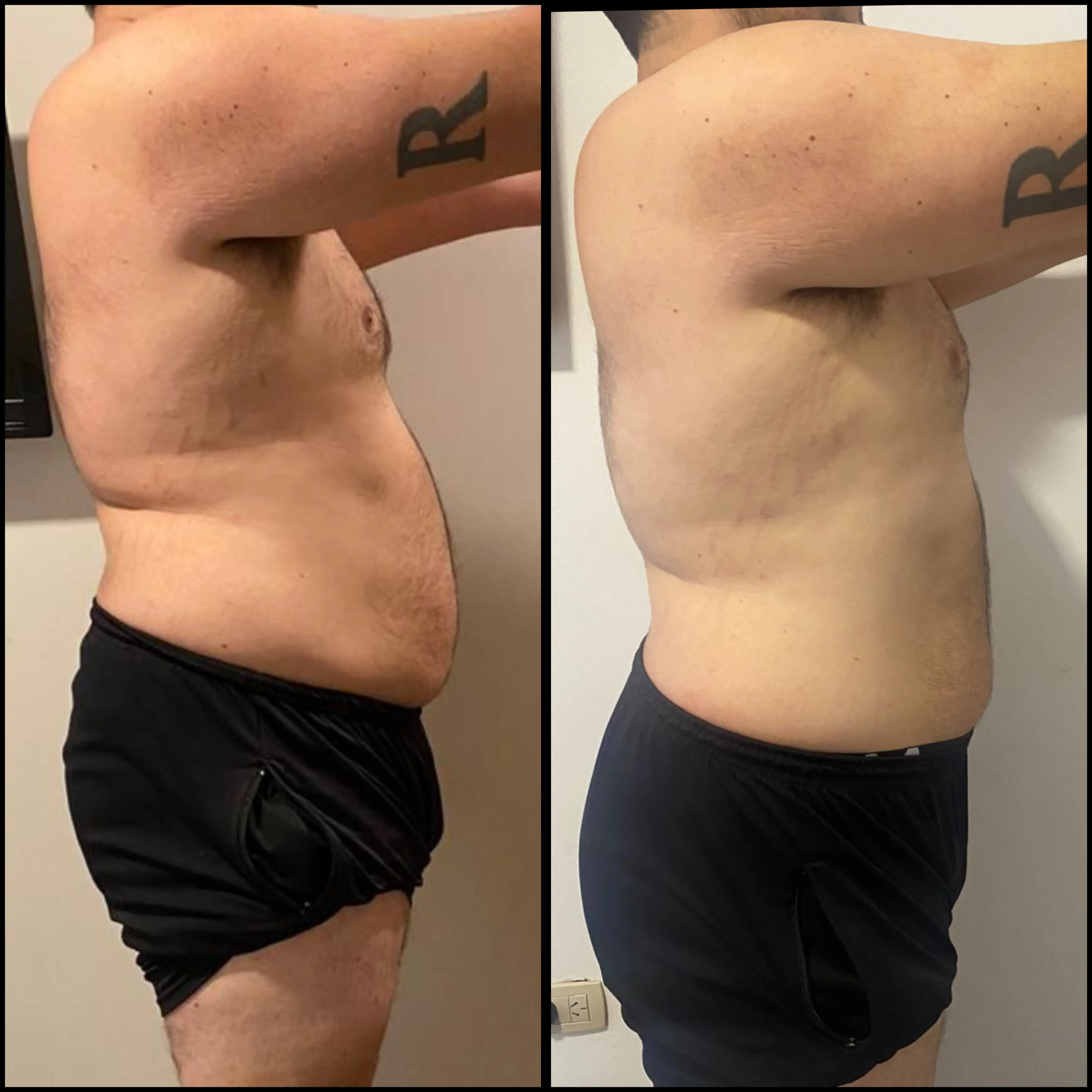 Transformación de Esteban